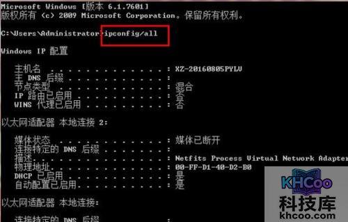 默认网关是多少