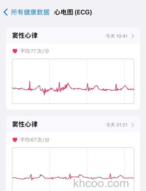 AppleWatch7怎么查看心电图数据 AppleWatch7心电图记录在哪看