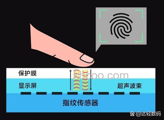 小米flipbudspro贴合度怎么检测-贴合度检测怎么看